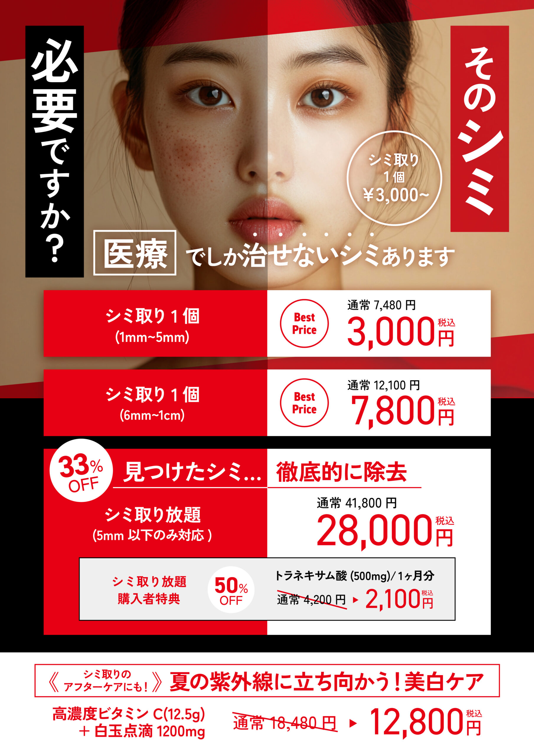 シミ取り放題キャンペーン