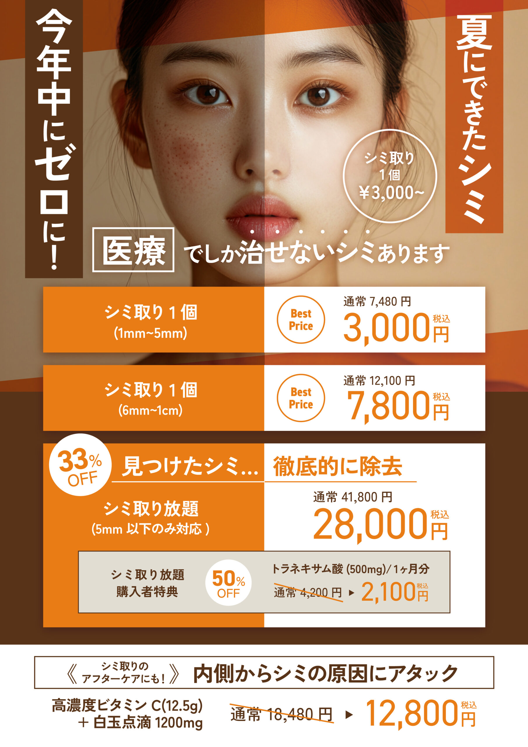 シミ取り放題キャンペーン